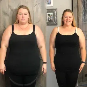 imgi_13_antes-e-depois-2-r87sjwdw1k56gk2ayhe2ugnon3ldud3gtiq4oe9hh4 (2)